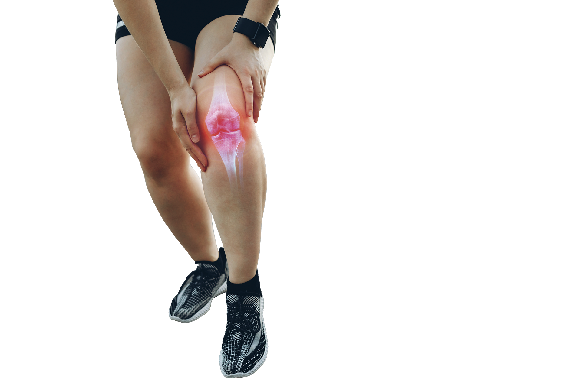 Cuál es el rol del ejercicio en la artrosis de rodilla? ¿Las protege o las  perjudica? - Opción Médica